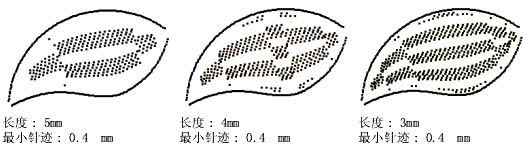 如何用自動分割針迹來(lái)分割長針迹